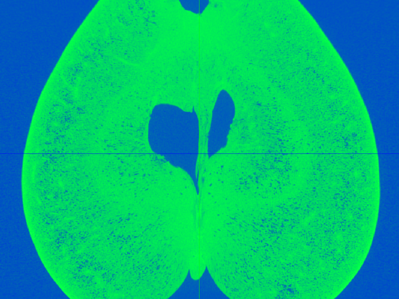 Doing quality measurements