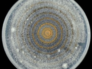 Antracnose in a petri dish. Photo by BENPOL/Shutterstock.com